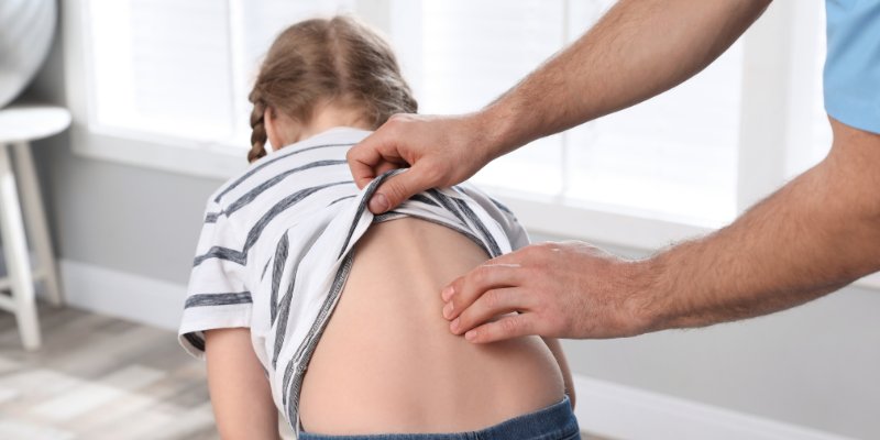 Scoliose : comprendre, traiter et soulager les douleurs dorsales