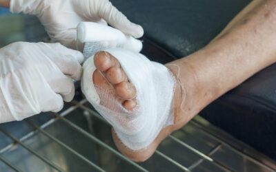 Pied diabétique : prévention, traitements et suivi podologique