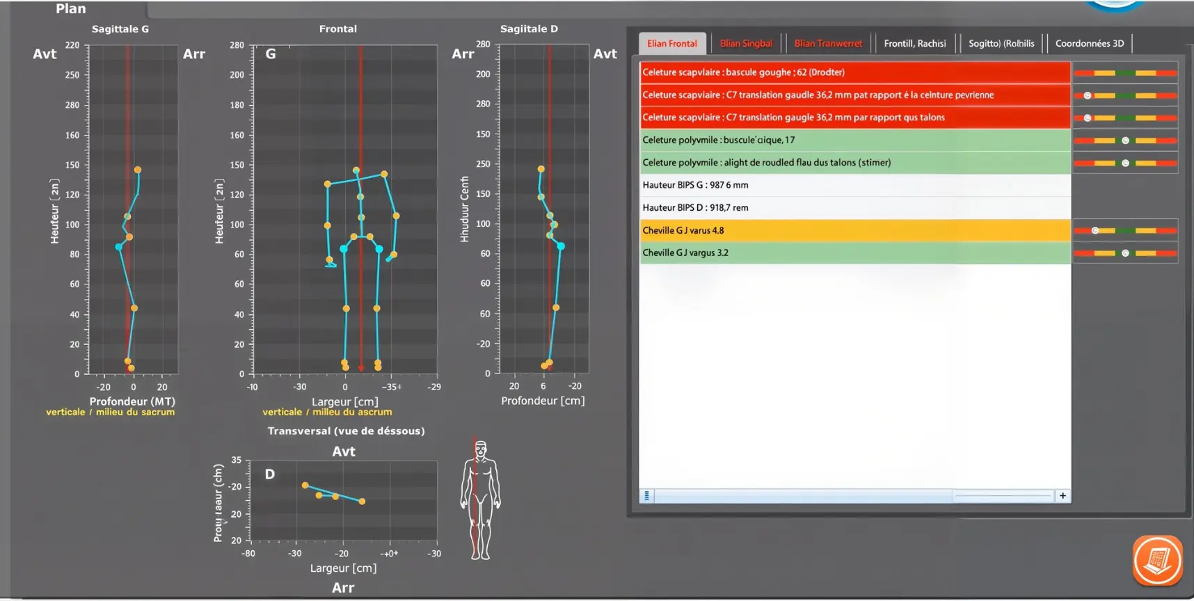 Écran d'analyse SAM3D
