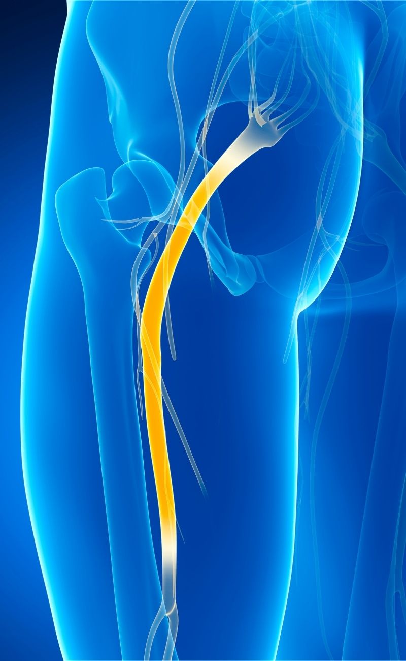 Diagnostic du nerf fibulaire